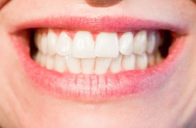 3 Ways to Whiten Teeth at Home 3 Ways to Whiten Teeth at Home