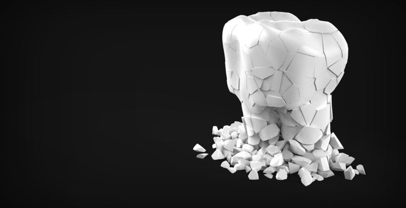 How to Stop Grinding Your Teeth How to Stop Grinding Your Teeth